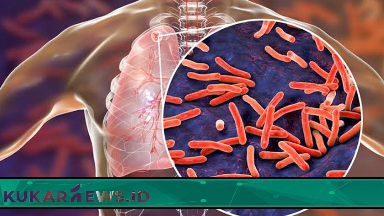 Percepatan Penanganan, Dinkes Kukar Lakukan Skrining Terhadap Potensi TBC